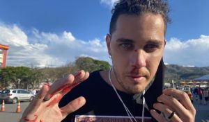 PM não prende e dá carona para agressor de cinegrafista em Aparecida