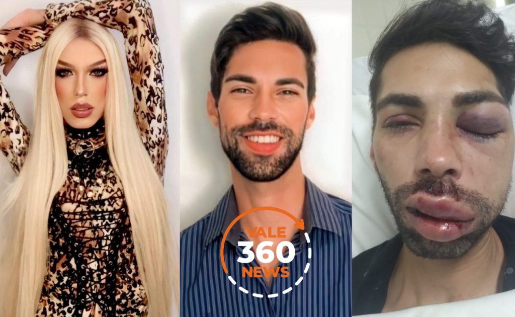 Miss Drag Queem São José dos Campos é brutalmente espancada e polícia investiga o caso