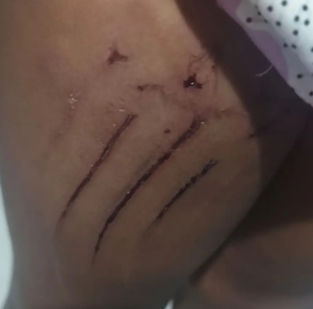 Criança ferida em escada rolante, onde fica o shopping Busca Busca em São José dos Campos